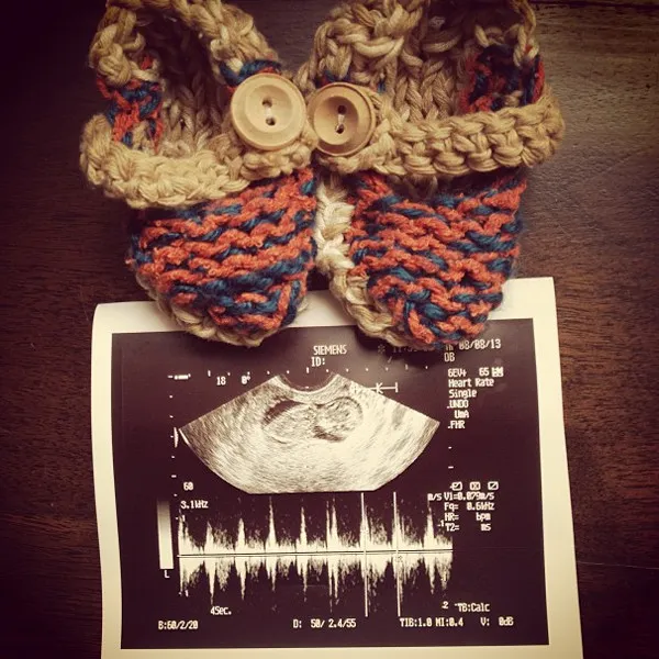 Hasil USG Teresa Palmer. @instagram