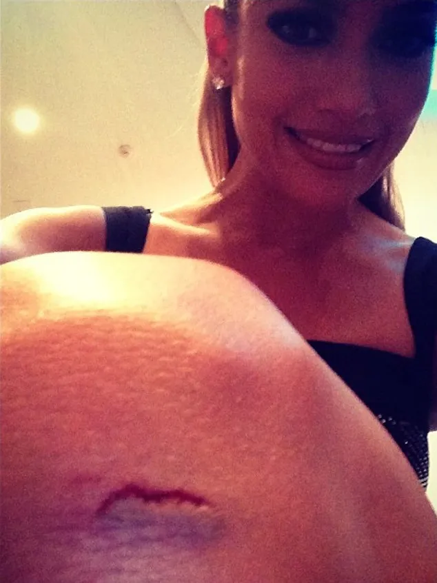 J.Lo tunjukkan cedera di lututnya ©eonline