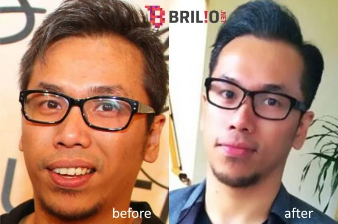 Perubahan Sammy yang bikin publik tercengang © Brilio