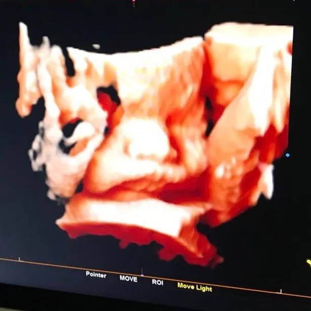 Foto hasil USG Franda yang diunggah Samuel © instagram.com/samuel_zylgwyn