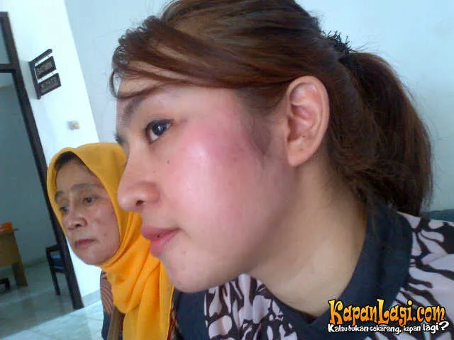 Citra Ria mengungkap dirinya ditampar dan dipukul sang suami.
