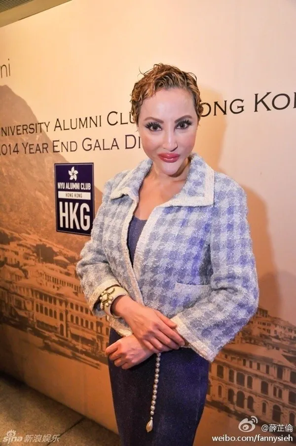 Fanny Sieh setelah operasi plastik. ©asiantown.net