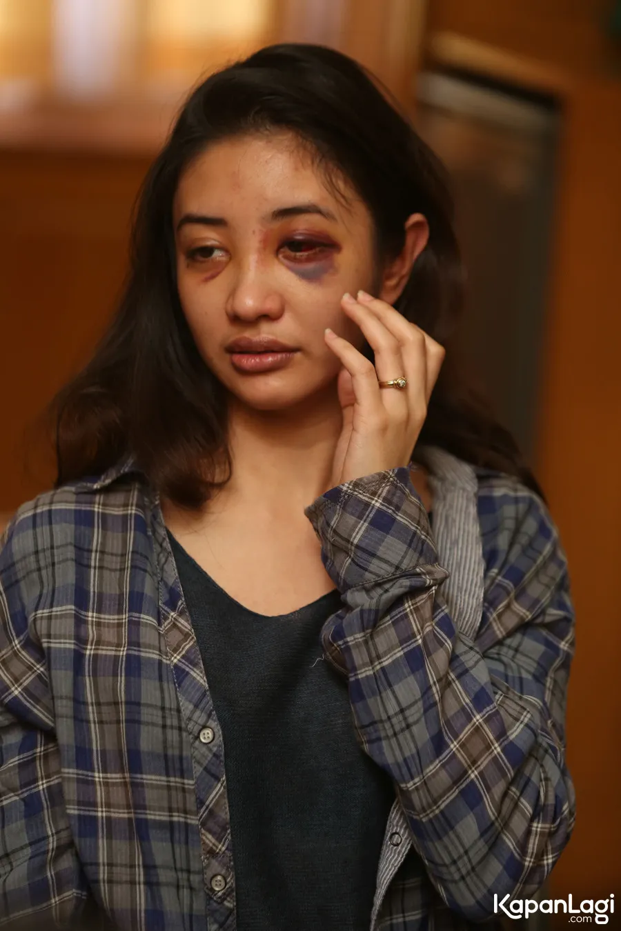 Kondisi tragis Saori Ishii yang dianaya pria berinisial JFJ. ©KapanLagi.com/Budy Santoso