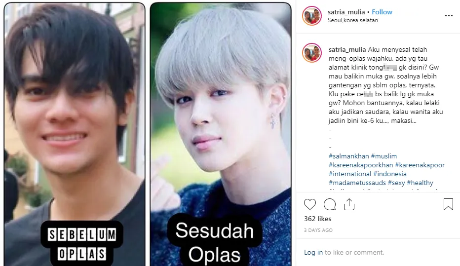 Satria Mulia bahas soal oplas di Instagram © KapanLagi.com®