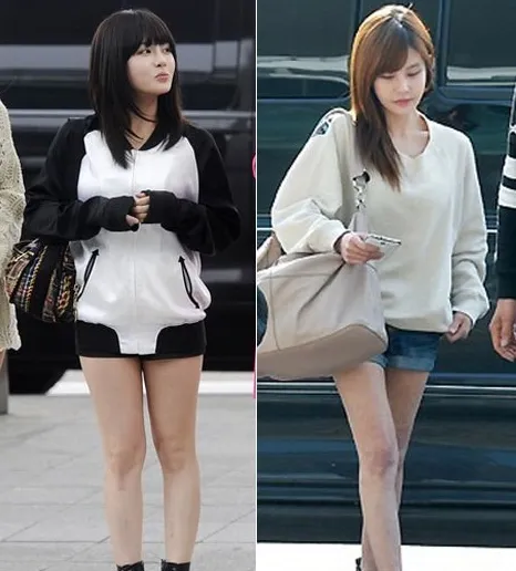 Bentuk kaki Boram T-Ara yang berbeda, akibat diet terlalu ketat? ©soompi.com