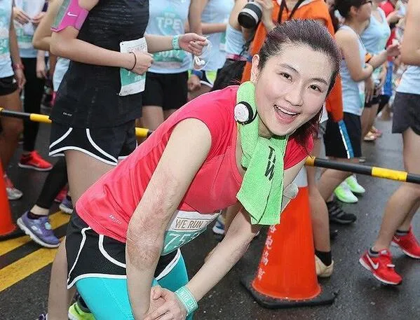 Selina Jen dengan semua bekas luka bakar yang semakin berkurang berkat operasi. © toggle.sg