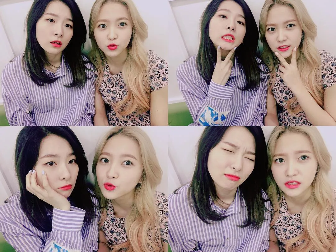 Seulgi dan yeri Red Velvet mengalami kecelakaan minor. ©Instagram/redvelvet.smtown