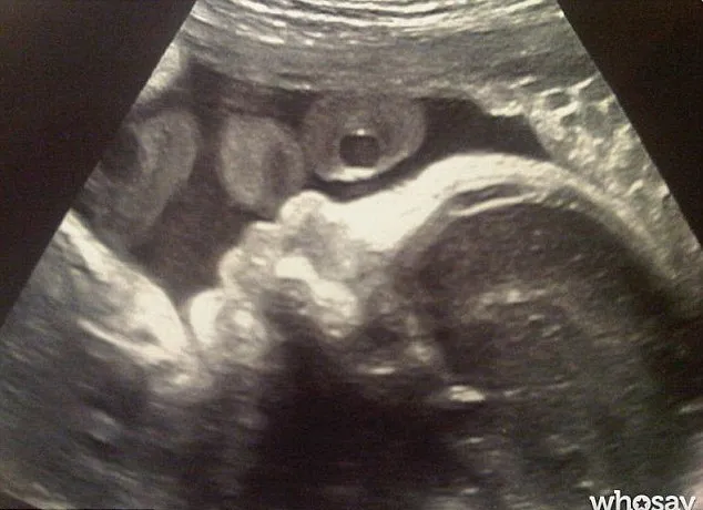 Bayi dalam kandungan Shakira @ dailymail.co.uk