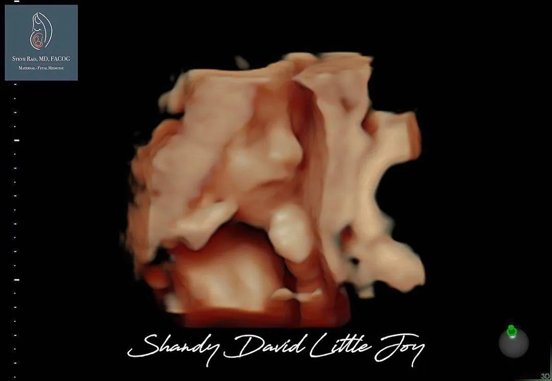  © instagram.com/shandyaulia