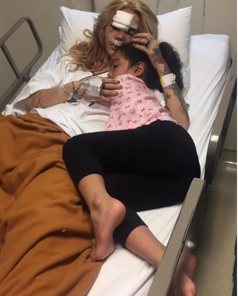 Sheila Marcia sudah sadarkan diri namun kondisi tubuhnya masih lebam © instagram.com/erie_nya