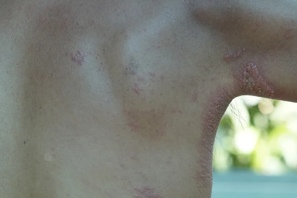 Ilustrasi (credit: Shutterstock)