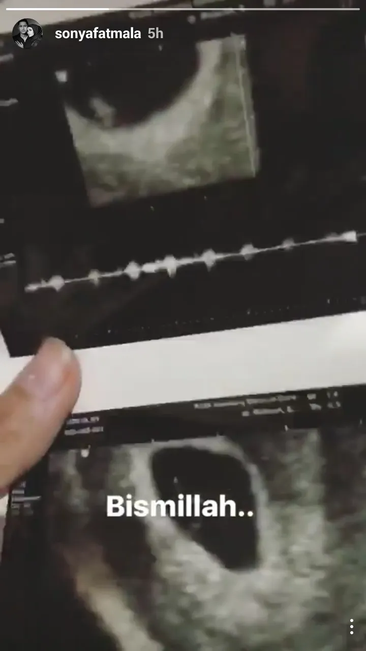 Kita tunggu tanggapan dari Sonya © instagram.com/sonyafatmala