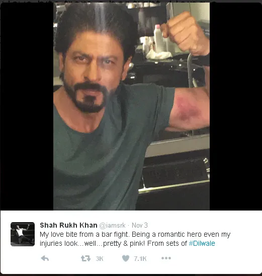 Ini dia luka memar di lengan SRK usai adegan berantem di bar © Twitter.com/iamsrk
