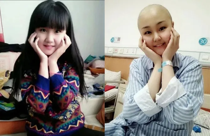 Sun Ying sebelum dan sesudah pengobatan foto: ©KapanLagi.com/nextshark.com