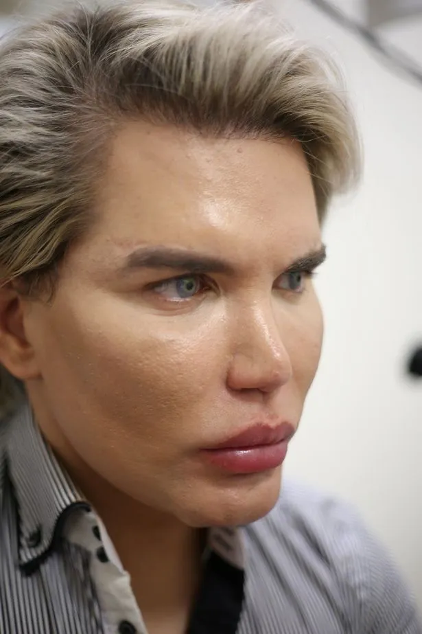 Rodrigo kali ini terbang ke India untuk menjalani operasi perubahan warna mata © mirror.co.uk