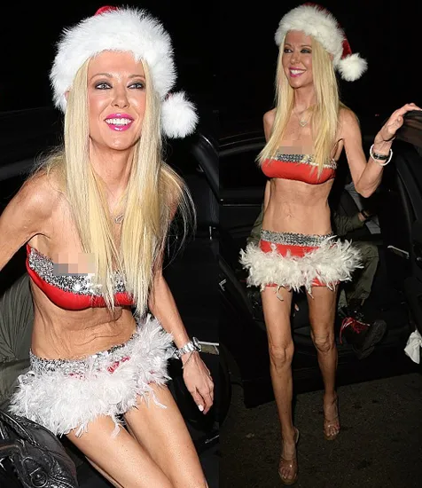 Yakin kamu nggak bakal ngeri saat melihat kondisi tubuhnya? © istimewa