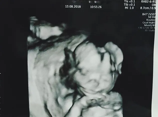 @instagram/tarrabudiman