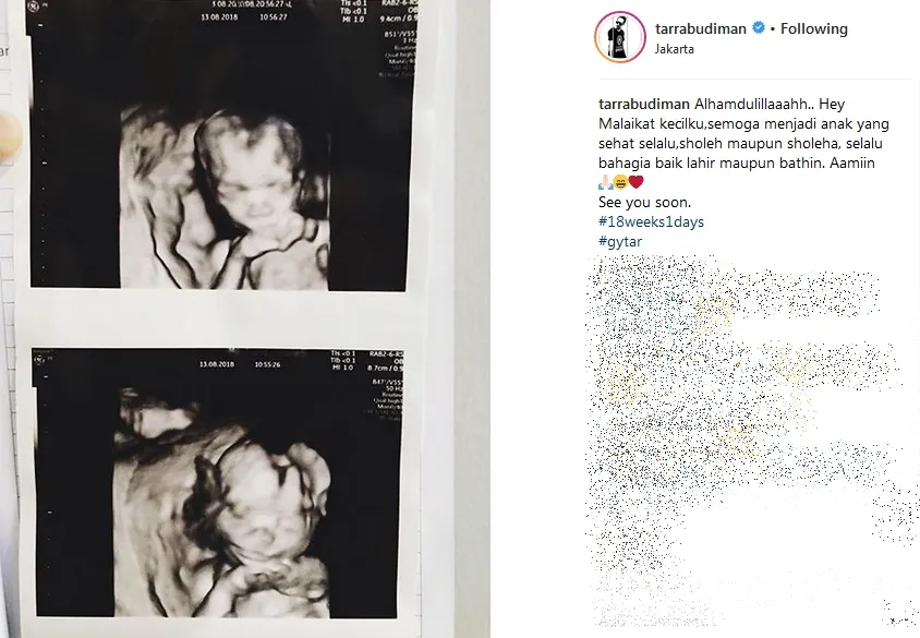 ©instagram.com/tarrabudiman