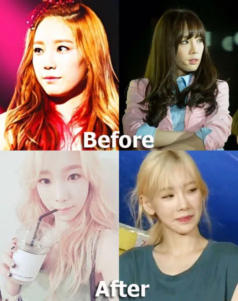 Foto lama Taeyeon dan terbaru, benarkah leader Girls Generation ini operasi tulang pipi? ©koreaboo.com
