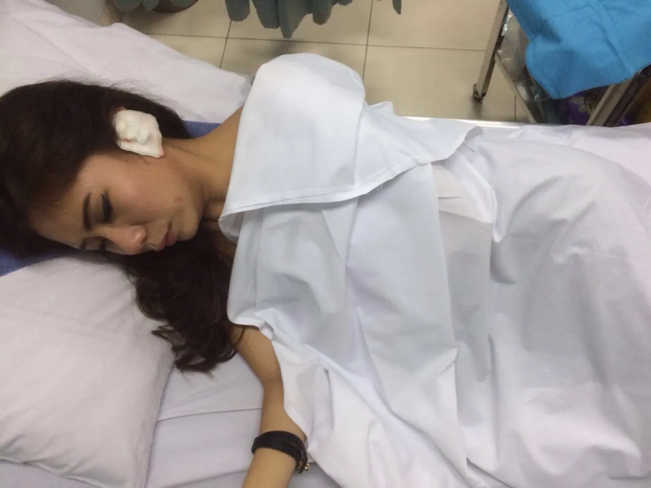 Thata dapat 4 jahitan di telinga © KapanLagi.com®/Sahal Fadhli
