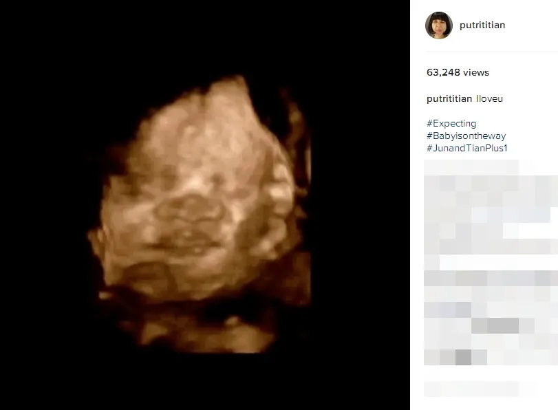 Wajah bayi di kandungan Putri Titian ©instagram