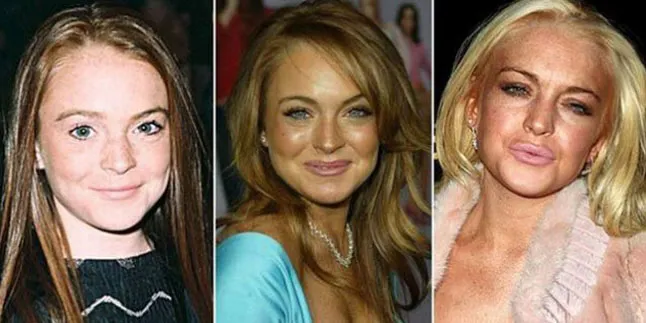 Lindsay Lohan yang cepat menua