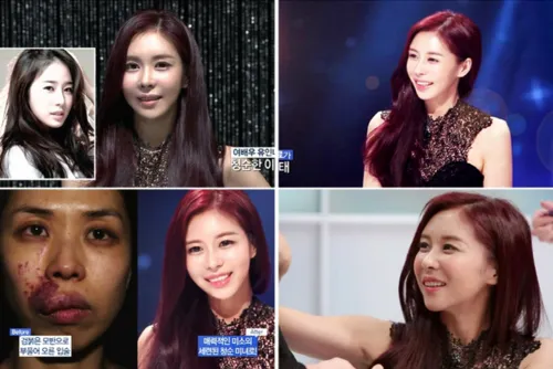 Operasi olastik mampu mengubah wajah seorang wanita menjadi sangat cantik. ©koreaboo