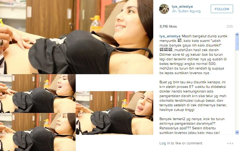 Tya Ariestya Masih Sempat Selfie Saat Akan Disuntik © Instagram tya_ariestya
