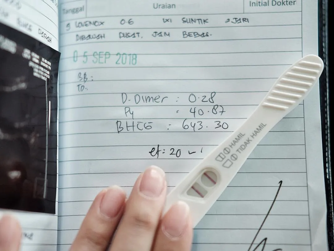 © instagram.com/tya_ariestya