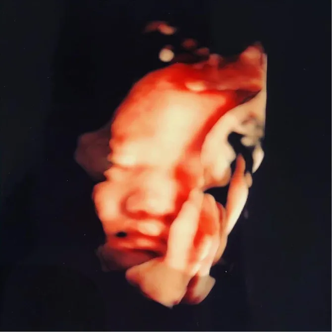 Hasil foto USG bayi Tara Budiman (Credit: instagram.com/tarrabudiman)