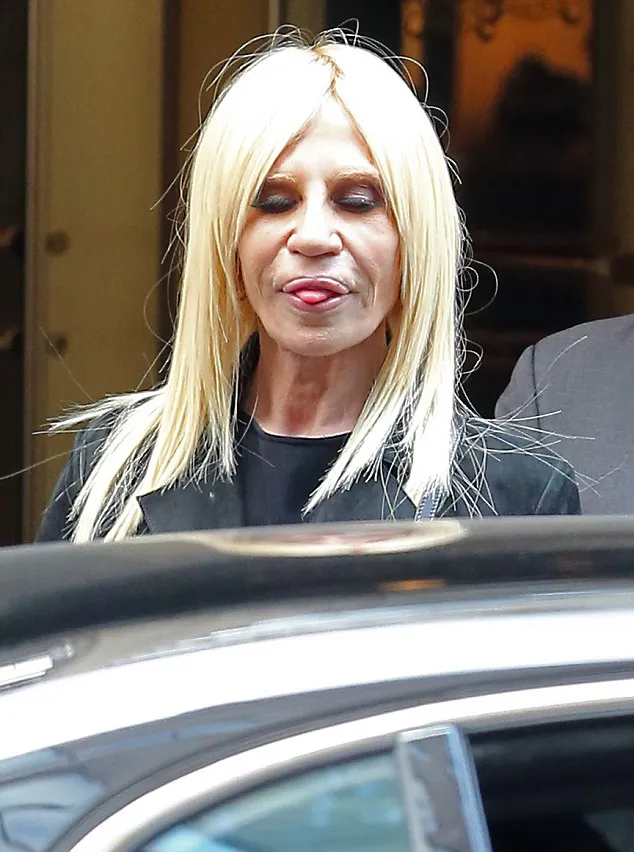 Donatella dengan bibir tebalnya, cantik? @ dailymail.co.uk