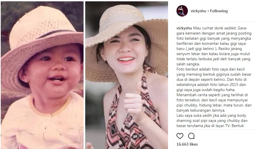Vicky buktikan giginya sudah kelinci sejak dulu ©instagram/vickyshu
