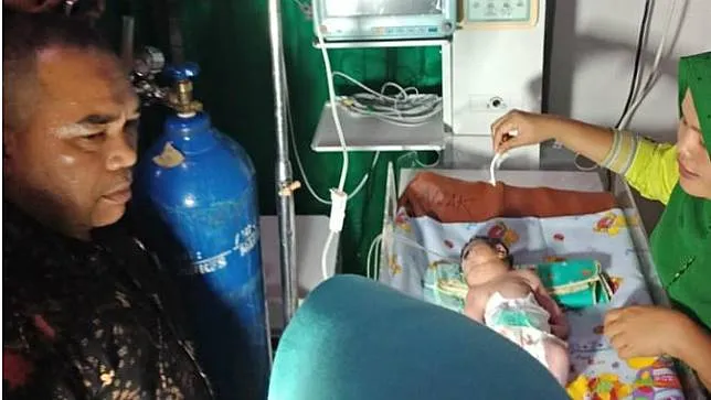 Bayi Bermata Satu © Liputan 6