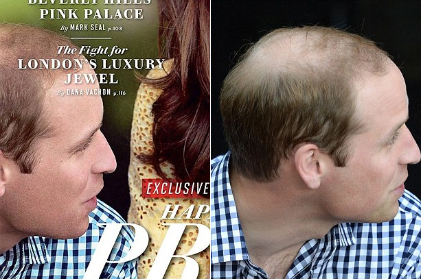 Pangeran William sebelum dan sesudah diedit @ dailymail.co.uk