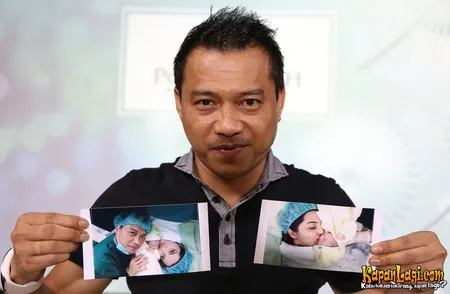 Foto Anang Hermansyah