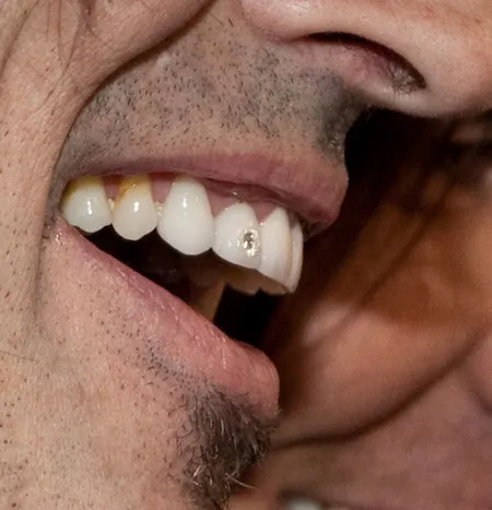 Foto Tommy Lee