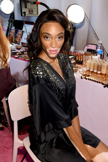 Foto Winnie Harlow