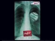 Baseball X-Ray
