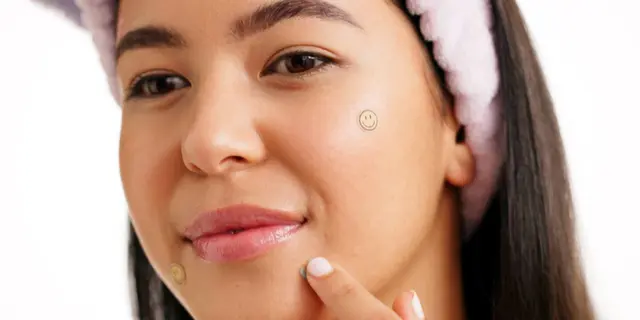 Bye Jerawat Meradang, Ini Acne Patch Terbaik yang Lagi Banyak Dicari 8