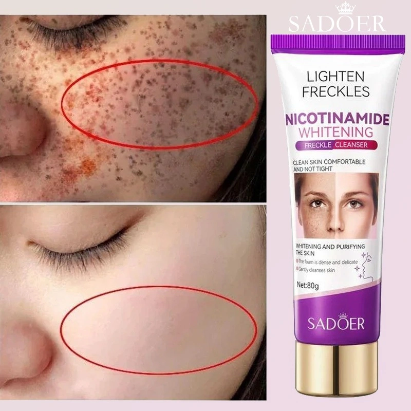 Facial Wash Anti-Spot Pembersih Wajah Anti Bintik 80g 100% Ampuh Menghilangkan Flek Hitam Asli Impor
