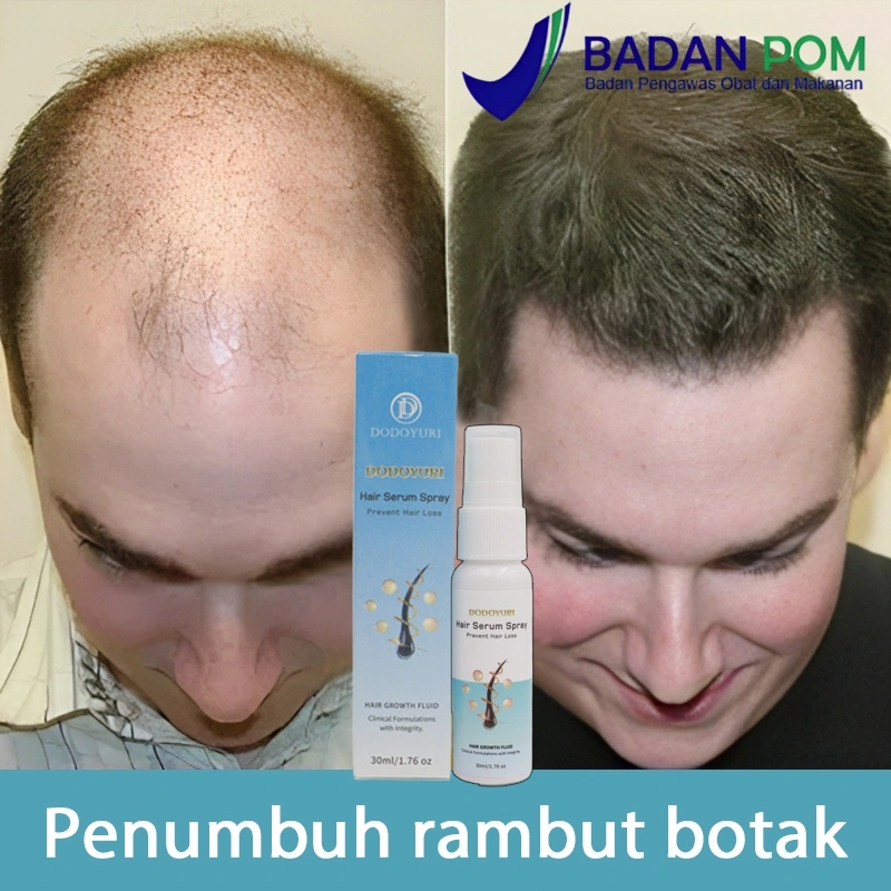 (BPOM)Serum penumbuh rambut Obat penumbuh rambut Penumbuh rambut botak Hair growth serum 30ml Kontrol minyak Scalp essence Pertumbuhan rambut Menstabilkan akar rambut Menutrisi secara mendalam