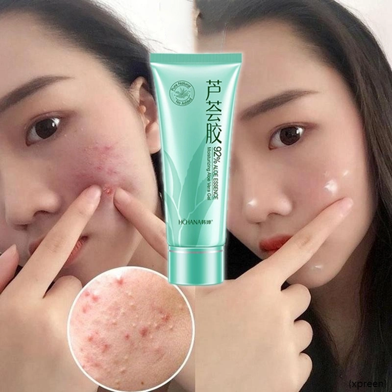 Hydrating Aloe Vera Gel Facial Moisturizer Gel Pelembab Untuk Menghilangkan Bekas Jerawat Dan Mengecilkan Pori-pori Aloe Vera Gel Aloe Vera Essence Facial Wash Sunburnt Repair Moisturing Facial Gel Skin Glowing Facial Wash