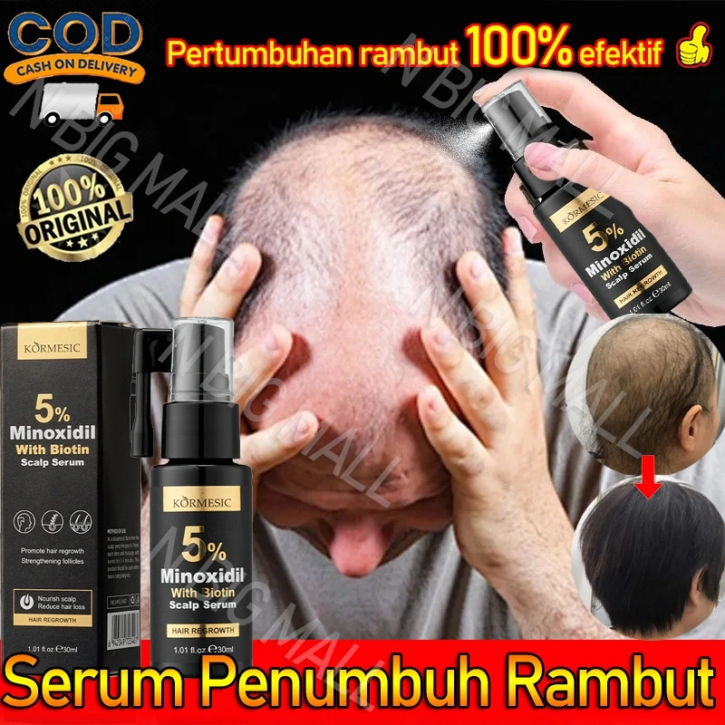 Serum Penumbuh Rambut cepat Hair Growth Spray Penumbuh rambut botak Obat Penebal Rambut Serum Penebal rambut Serum rambut rontok Serum anti hair fall Hair tonic Anti Rontok