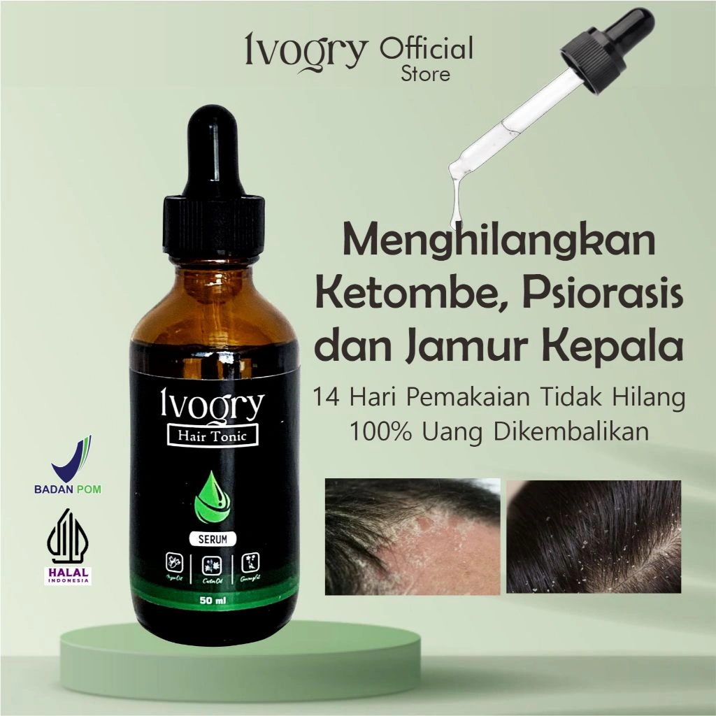 Ivogry Scalp Care – Serum Harian untuk Kulit Kepala | Ketombe & Gatal