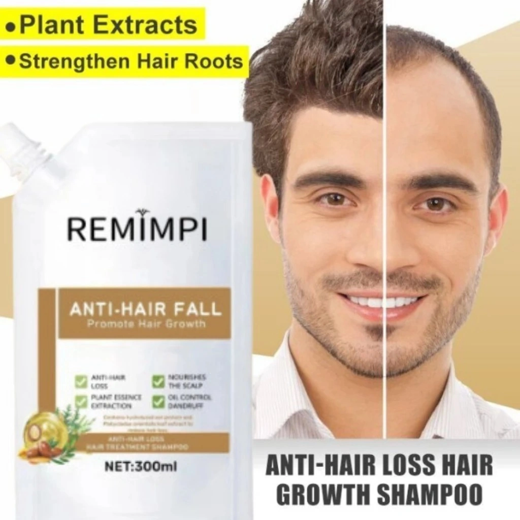 Remimpi Anti Rambut Rontok Anti Hair Fall | Hair Treatment Shampoo Oil Control | Remimpi Penumbuh Rambut 100% Original