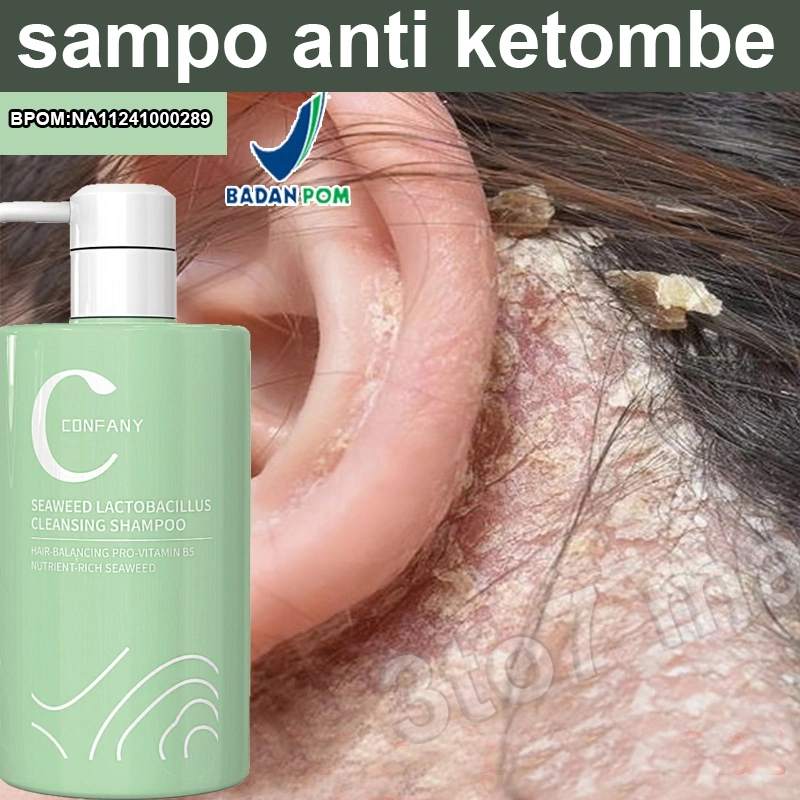 shampoo anti ketombe dan rontok 500ml Anti Gatal perawatan rambut ketombe Garam Laut Shampoo Obat Ketombe Rambut Rontok Berkerak Sampo anti dandruff shampoo