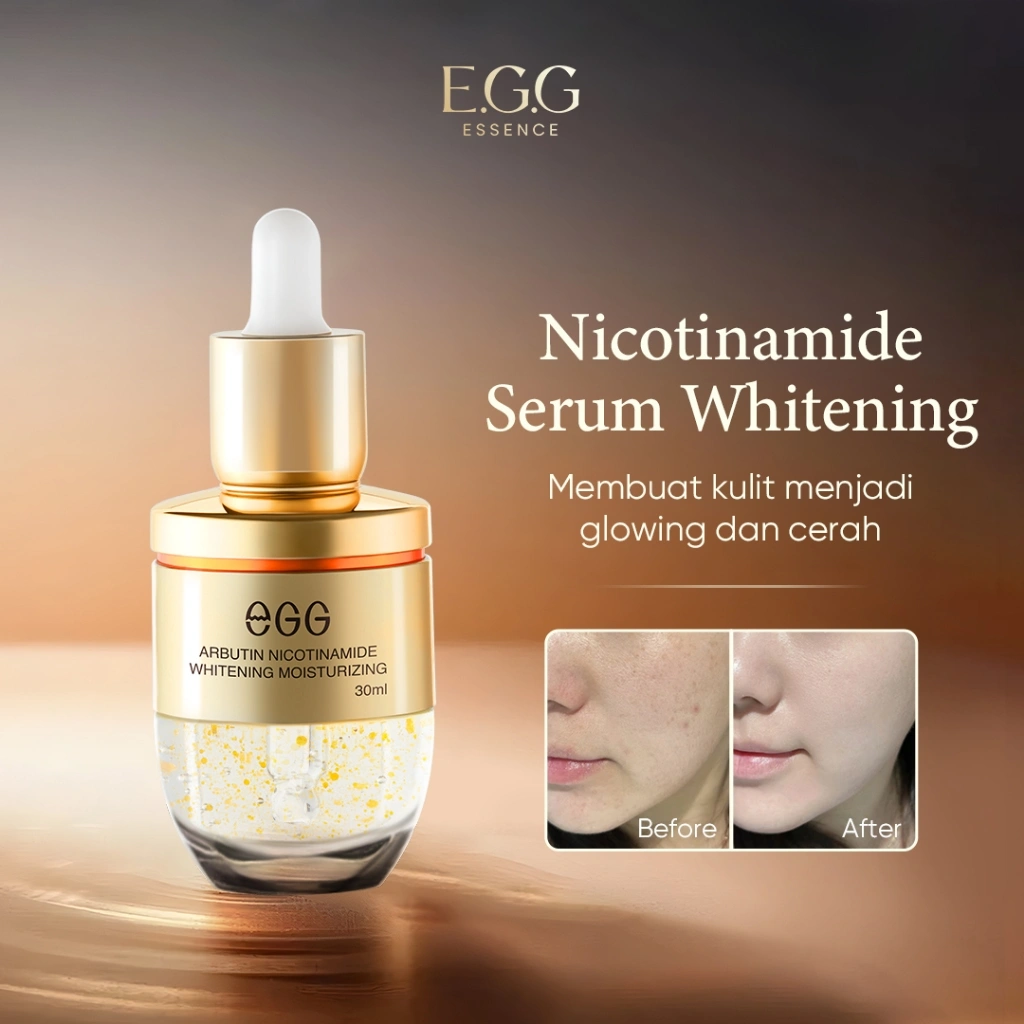 EGG-Niacinamide Serum Pemutih 30ML-Dark Spot Whitening Serum- Memudarkan flek hitam dalam-Mencerahkan warna kulit