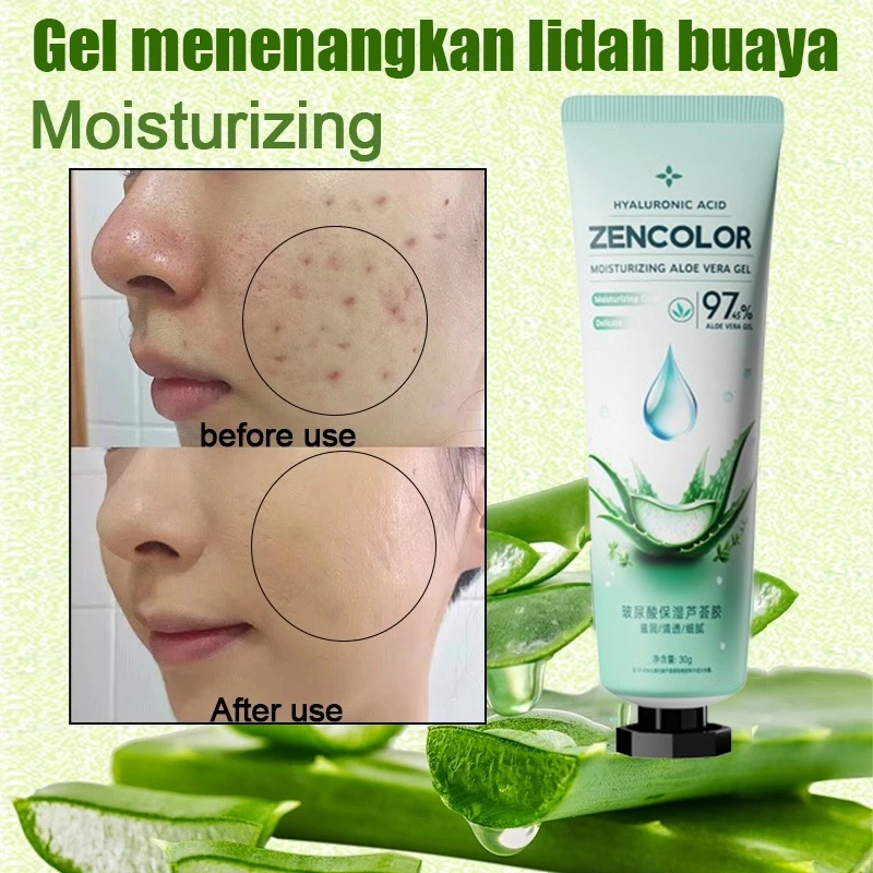 LUMAVOX Aloe Vera Gel Penghilang Bekas Jerawat Hitam Gel Lidah Buaya Moisturizer Gel Pelembab Kulit Soothing Gel Perawatan After Sun