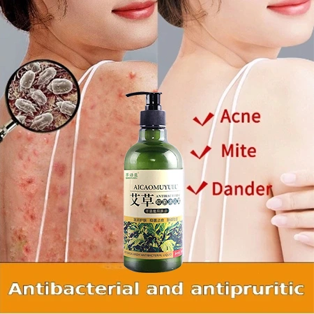 sabun jerawat badan 500ML Acne Shower Gel Aroma Alami Mengatasi Kulit Jerawa Sabun jerawat punggung ance Body wash whitening