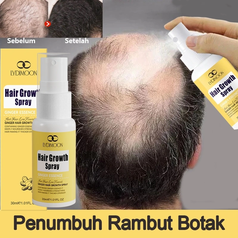 LYDIMOON Serum Penumbuh Rambut Ekstrak Jahe & Saffron Anti Rontok Aman untuk Ibu Menyusui
